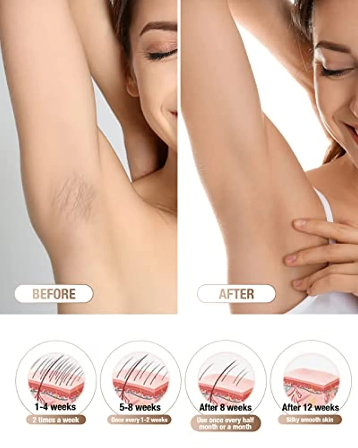 Laser Hair Removal for Women Permanent - IPL Hair Removal with 2 Intelligent Attachments for Whole Body, Ice Painless Hair Removal At Home